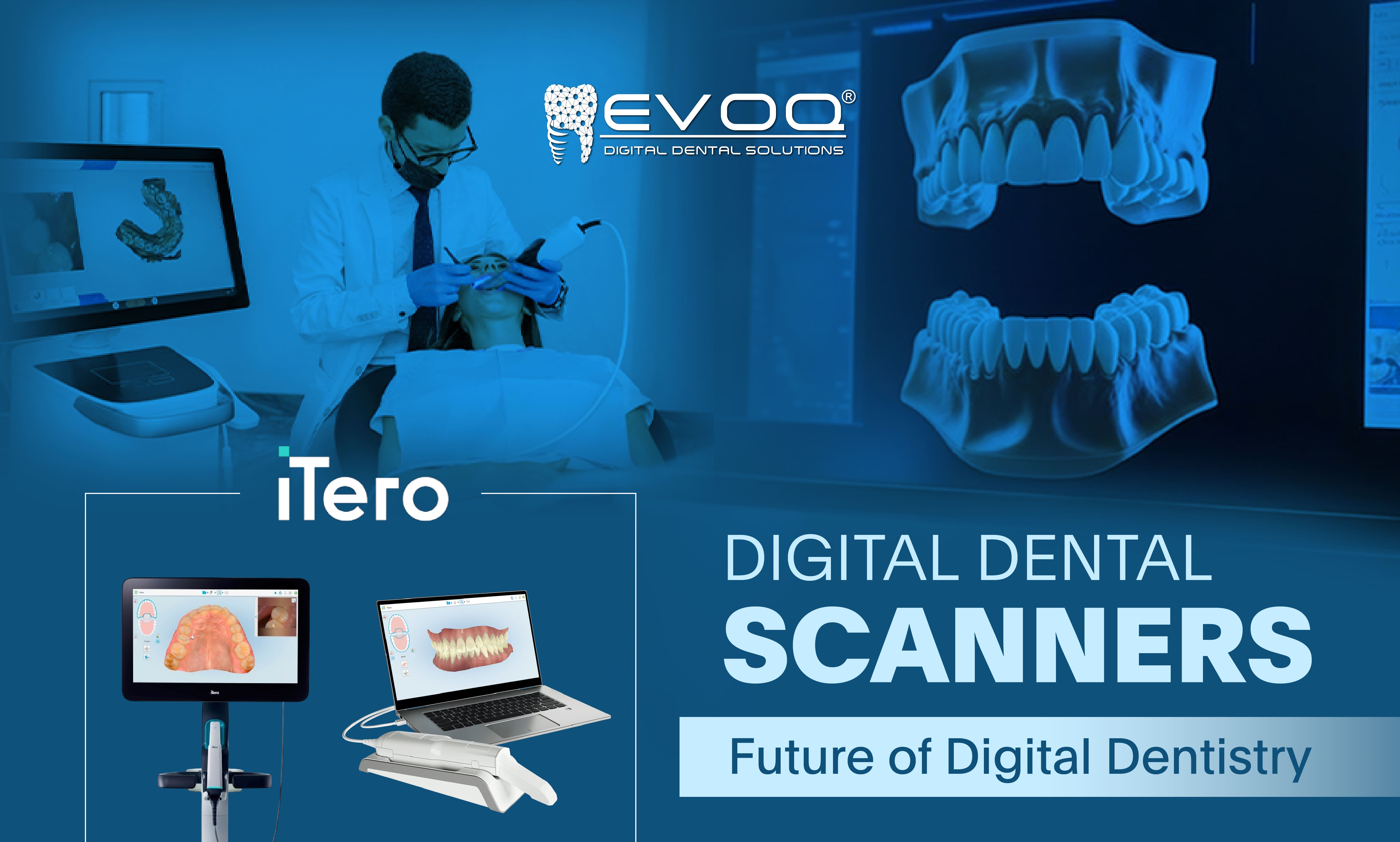 Intraoral Scanners: The First Step Toward a Fully Digital Dental Lab Experience