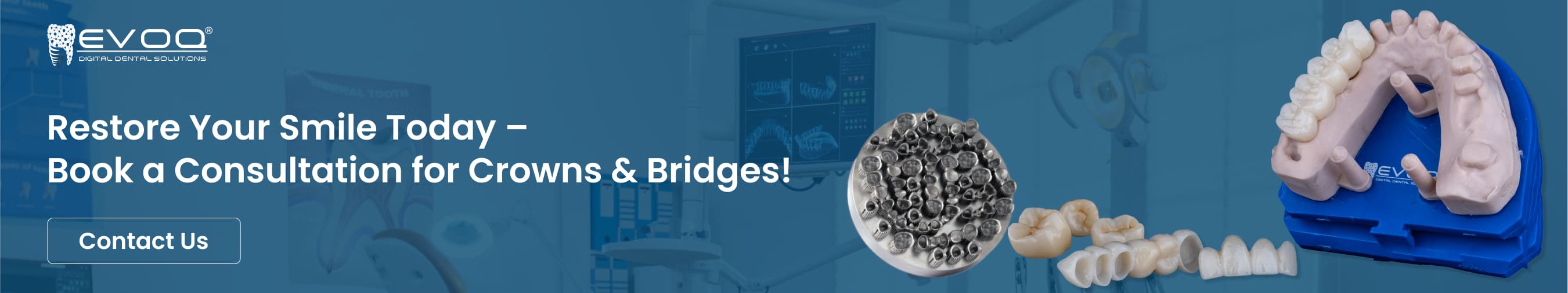 dental crowns and bridges guide